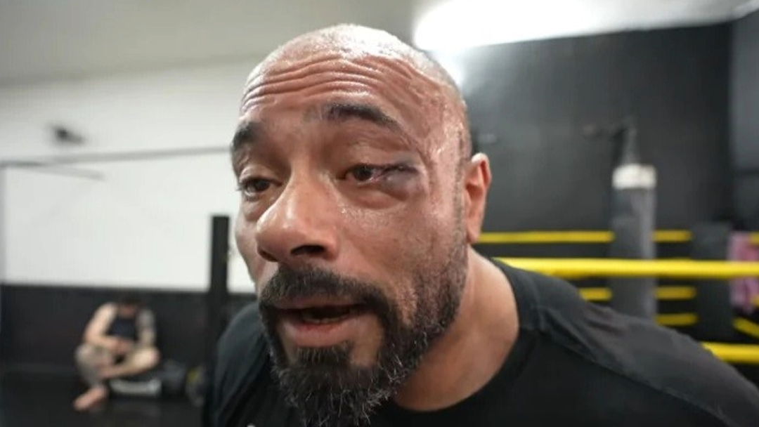 bales VF Comunica Bodybuilder fica com o olho roxo depois de desafiar lutadora do UFC